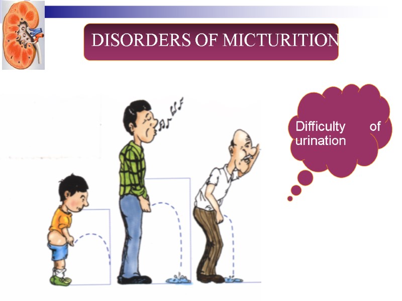 Difficulty of urination DISORDERS OF MICTURITION